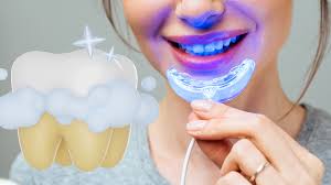 best teeth whitening kit